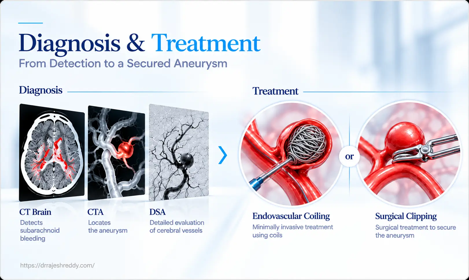 Diagnosing and Treating SAH