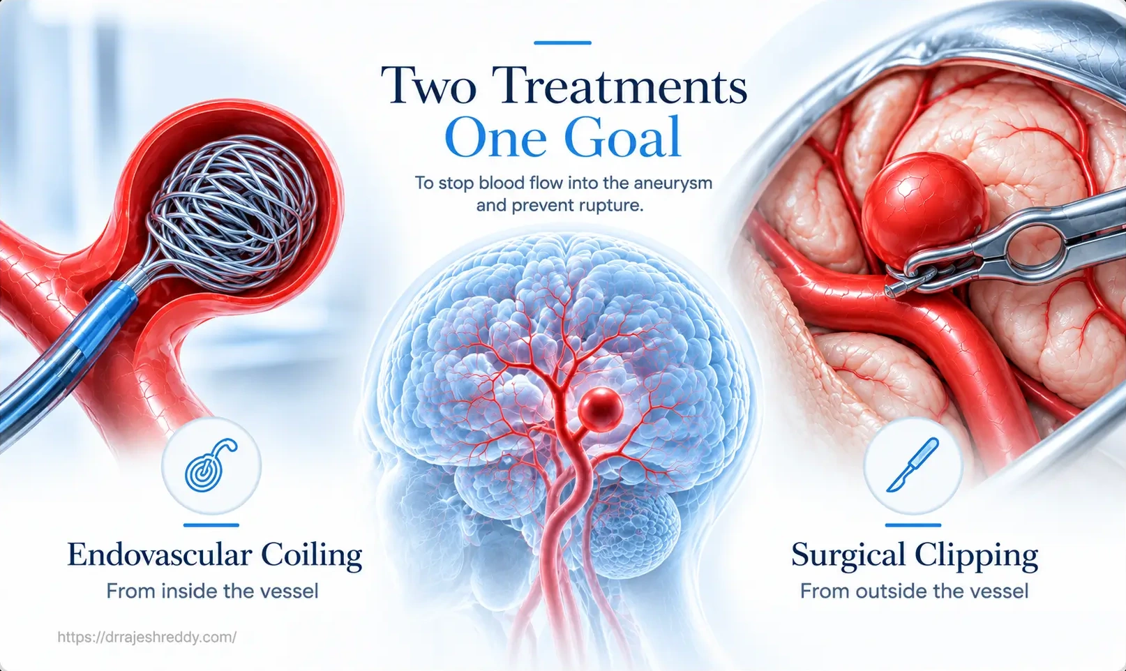 Consult Dr. Rajesh Reddy for Aneurysm Evaluation