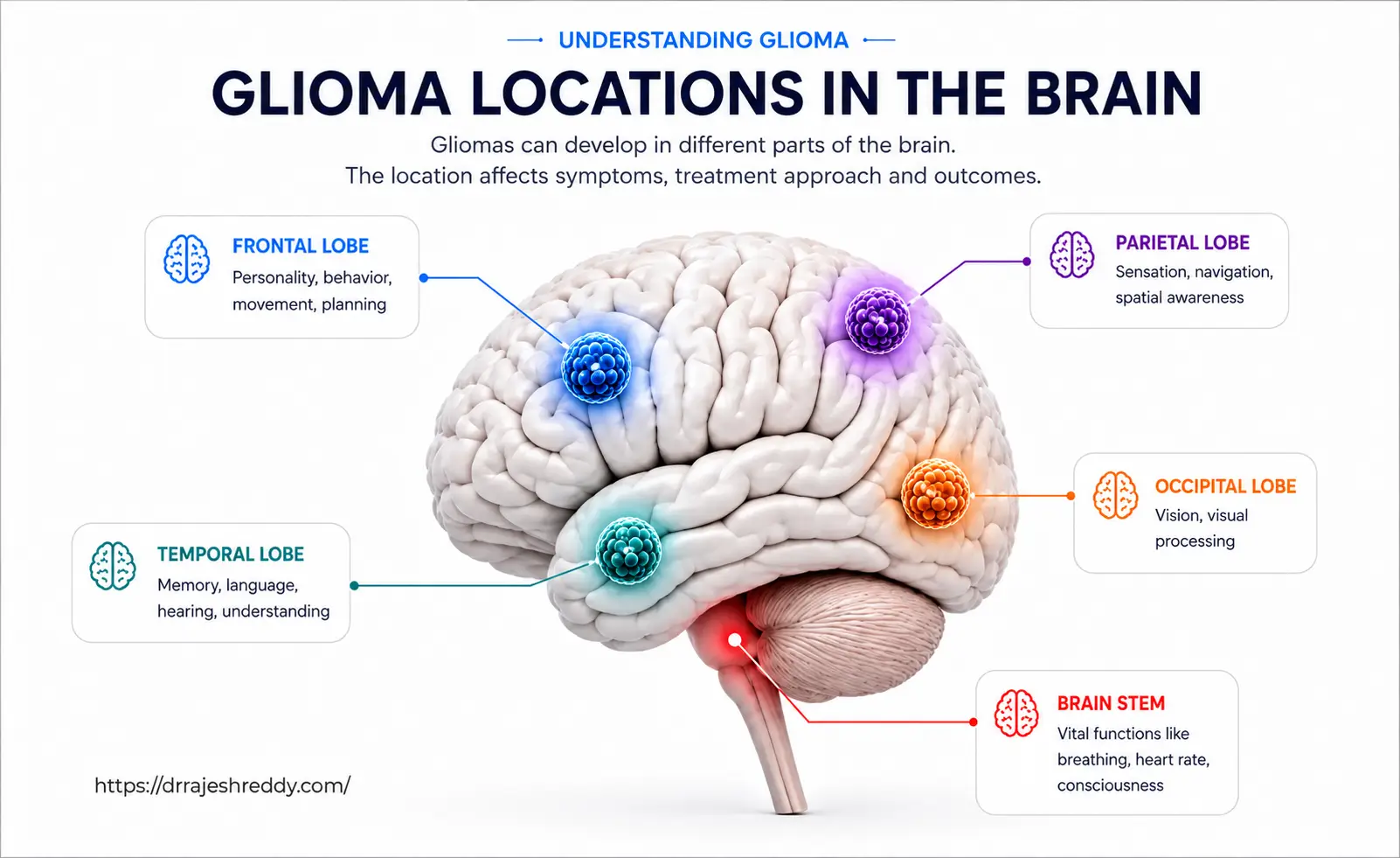 Glioma Locations in the Brain