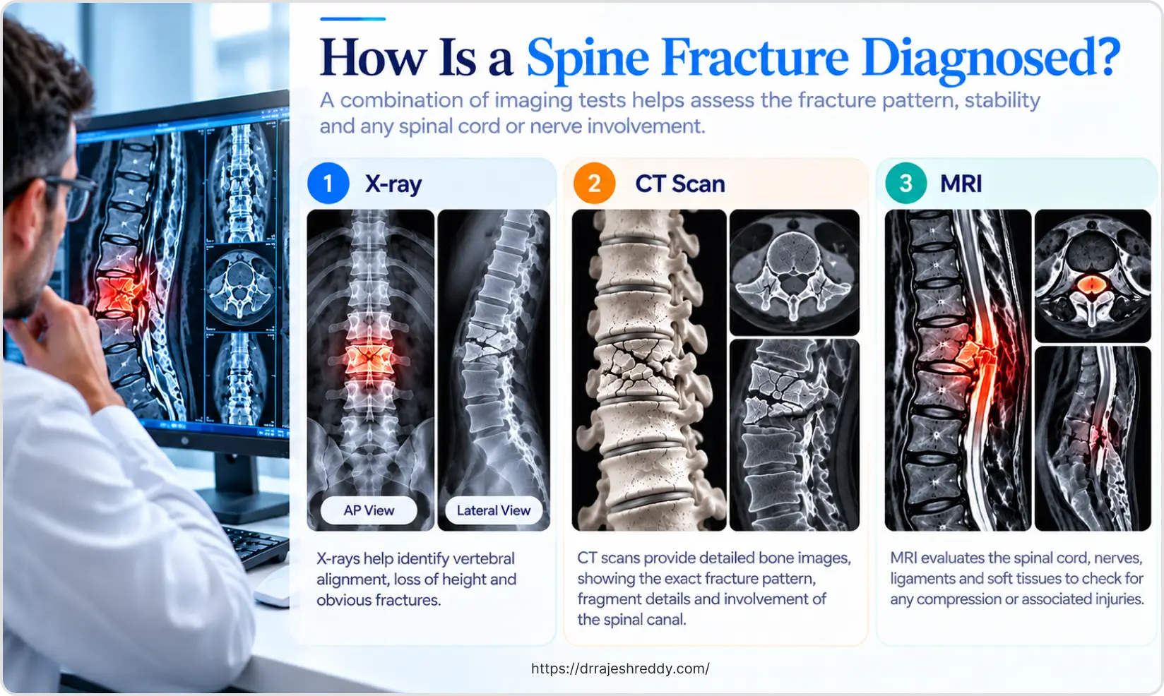 Diagnosing a Spine Fracture: The Workup